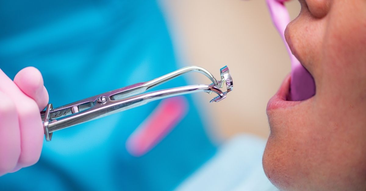 Primero plano de las manos de una dentista sosteniendo material odontológico frente a la boca abierta de un paciente.