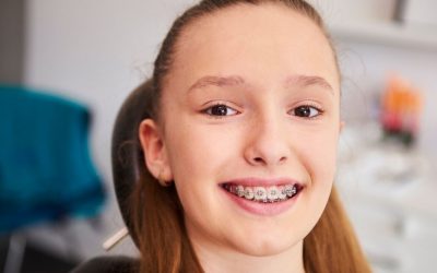 ¿Qué tipos de brackets hay y en qué se diferencian?