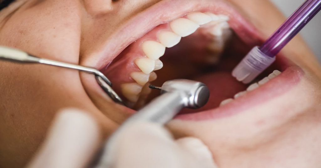 Detalle de un hombre en una consulta sometiéndose a un curetaje dental