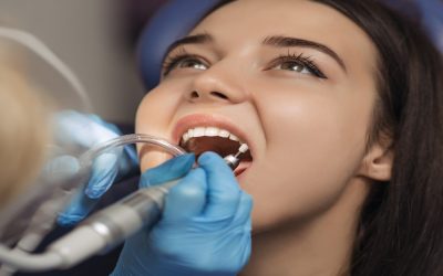 Profilaxis dental: qué es, para qué sirve y cuándo hacerla