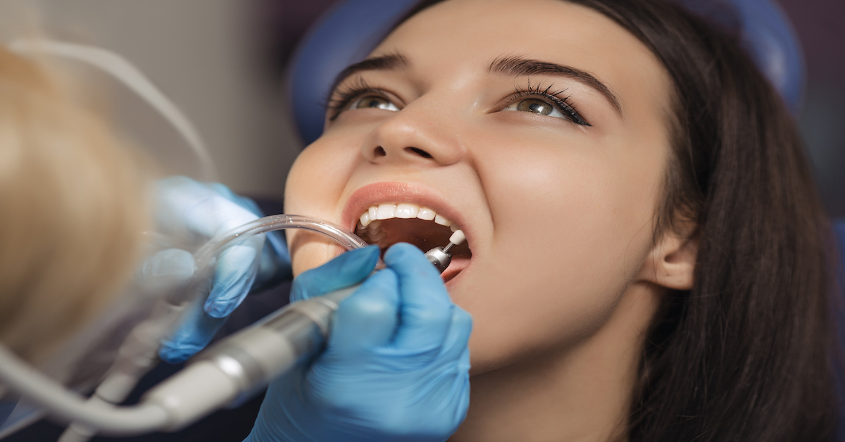 Plano detalle de una profilaxis dental
