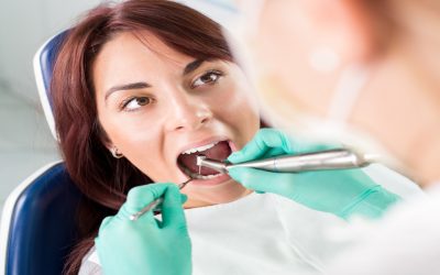 ¿Qué es un curetaje dental? Todo lo que debes saber