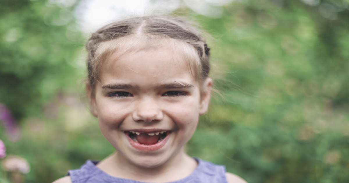 niña con agenesia dental